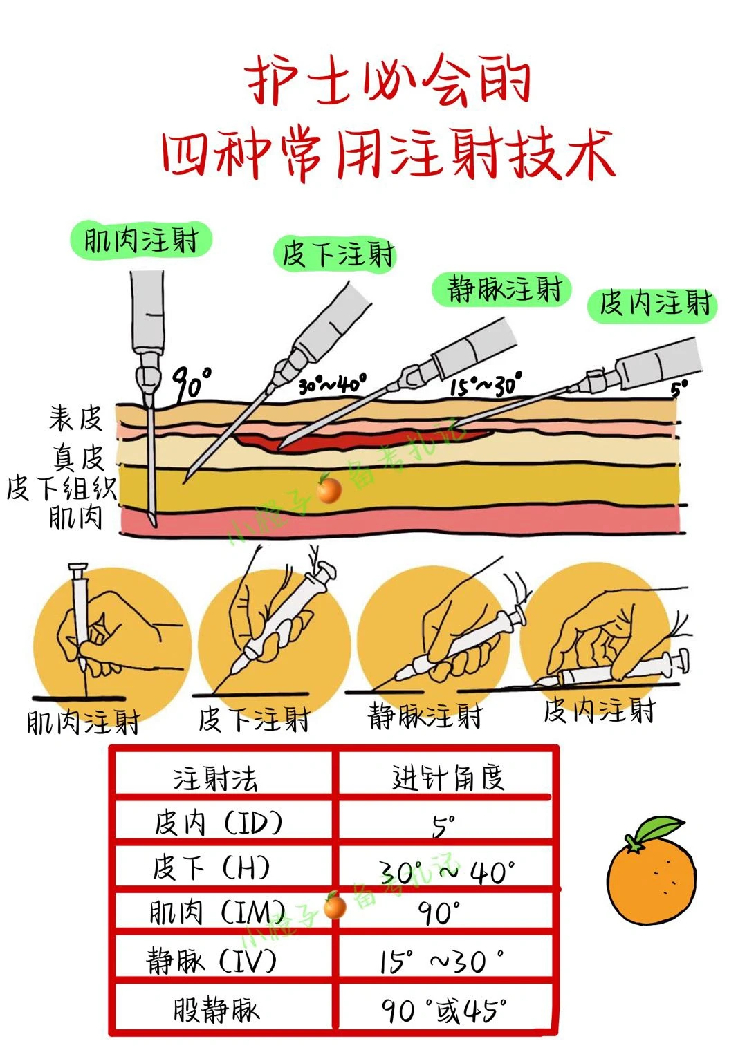 📖护师笔记｜护士必会的4⃣️种常用注射技术🔥