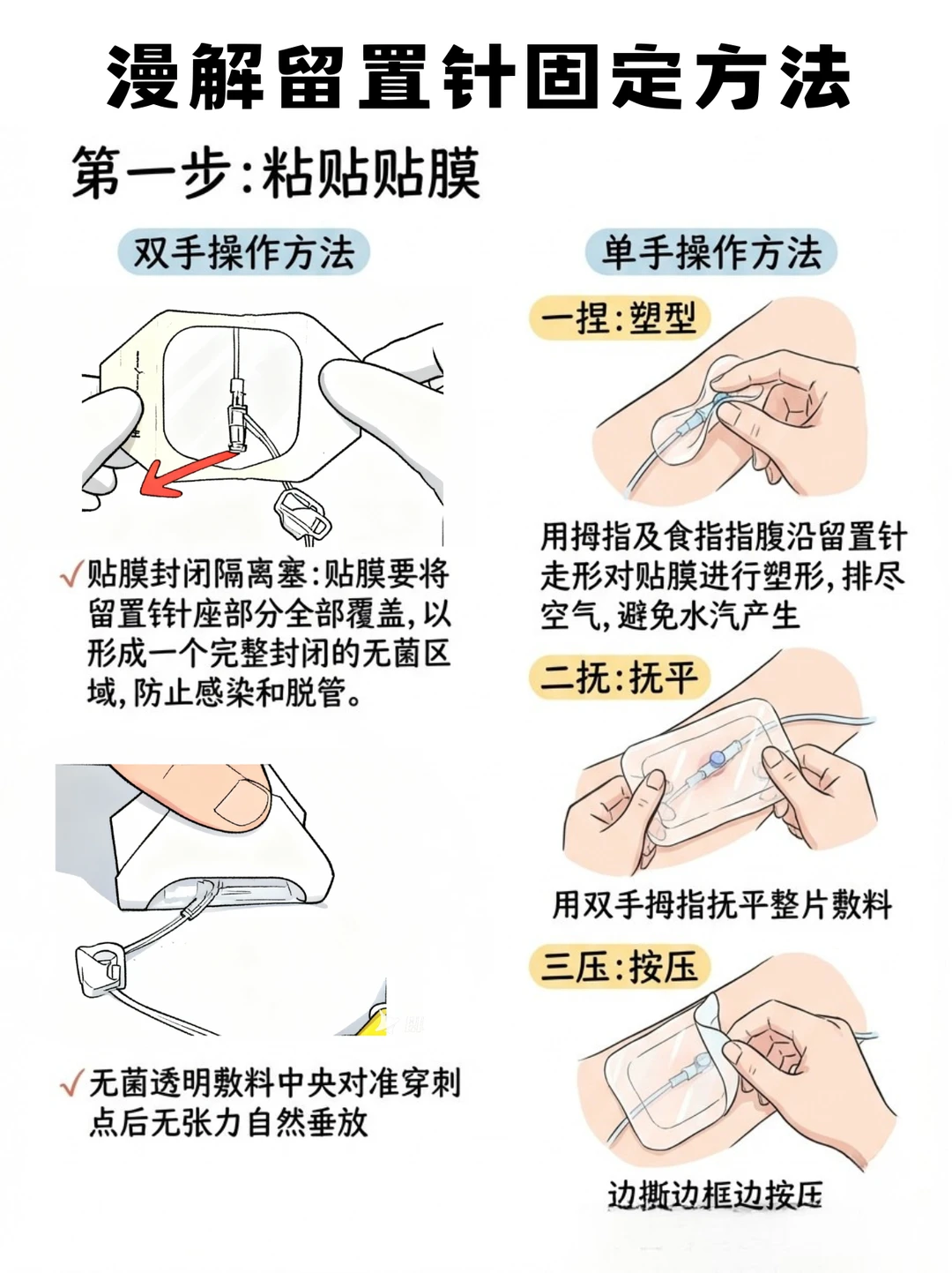 阿虎医考笔记：漫解留置针固定秘籍
