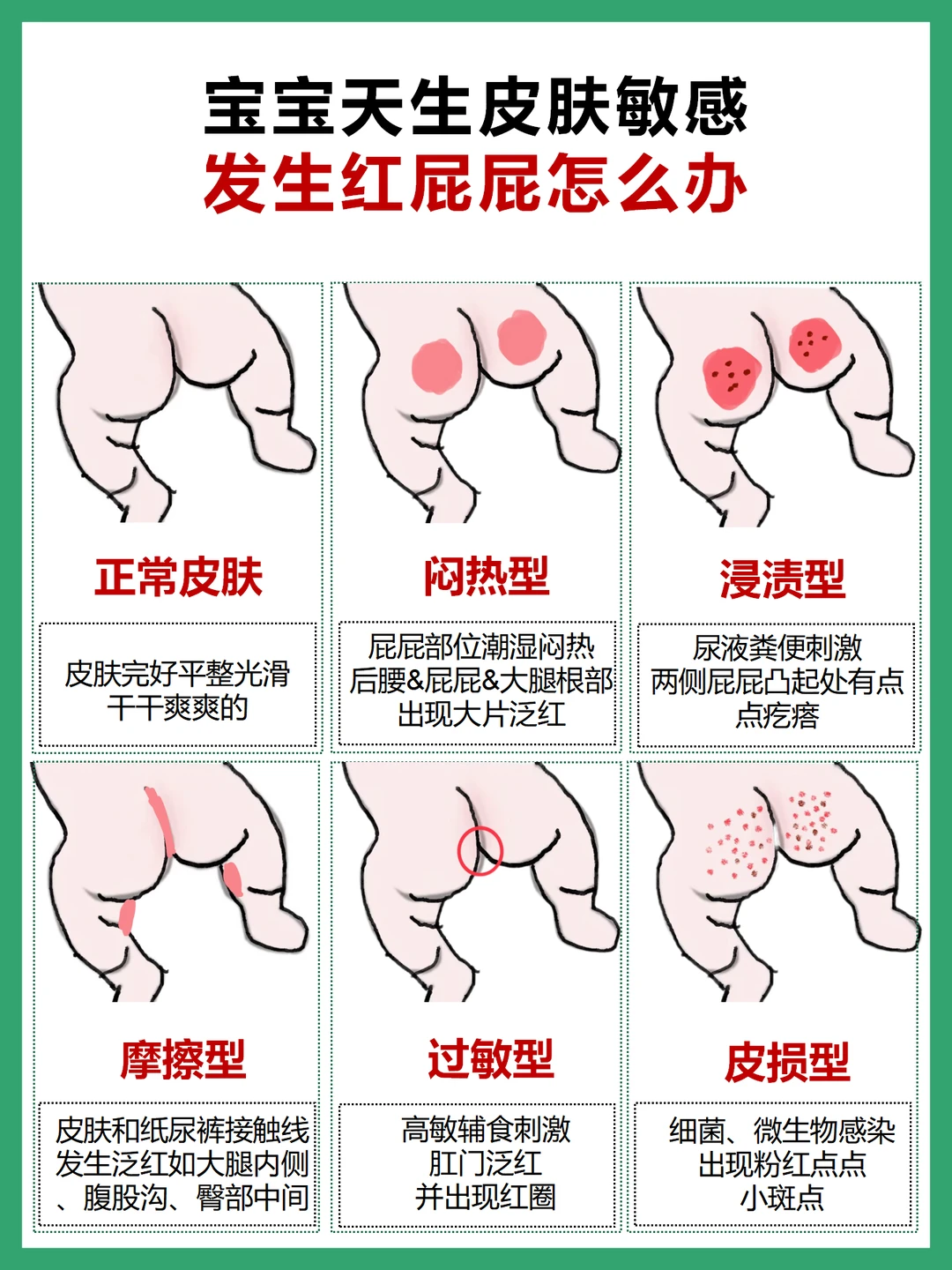 屁屁敏感别烦我！敏感肌宝宝纸尿裤这样选