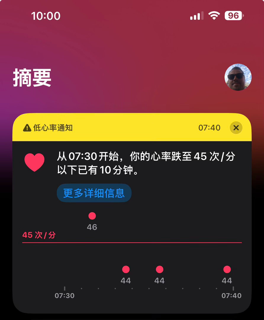 Apple watch 报警了，说我心率低于 45 次/分钟[哆啦A梦害怕]

怎么回事？ ​