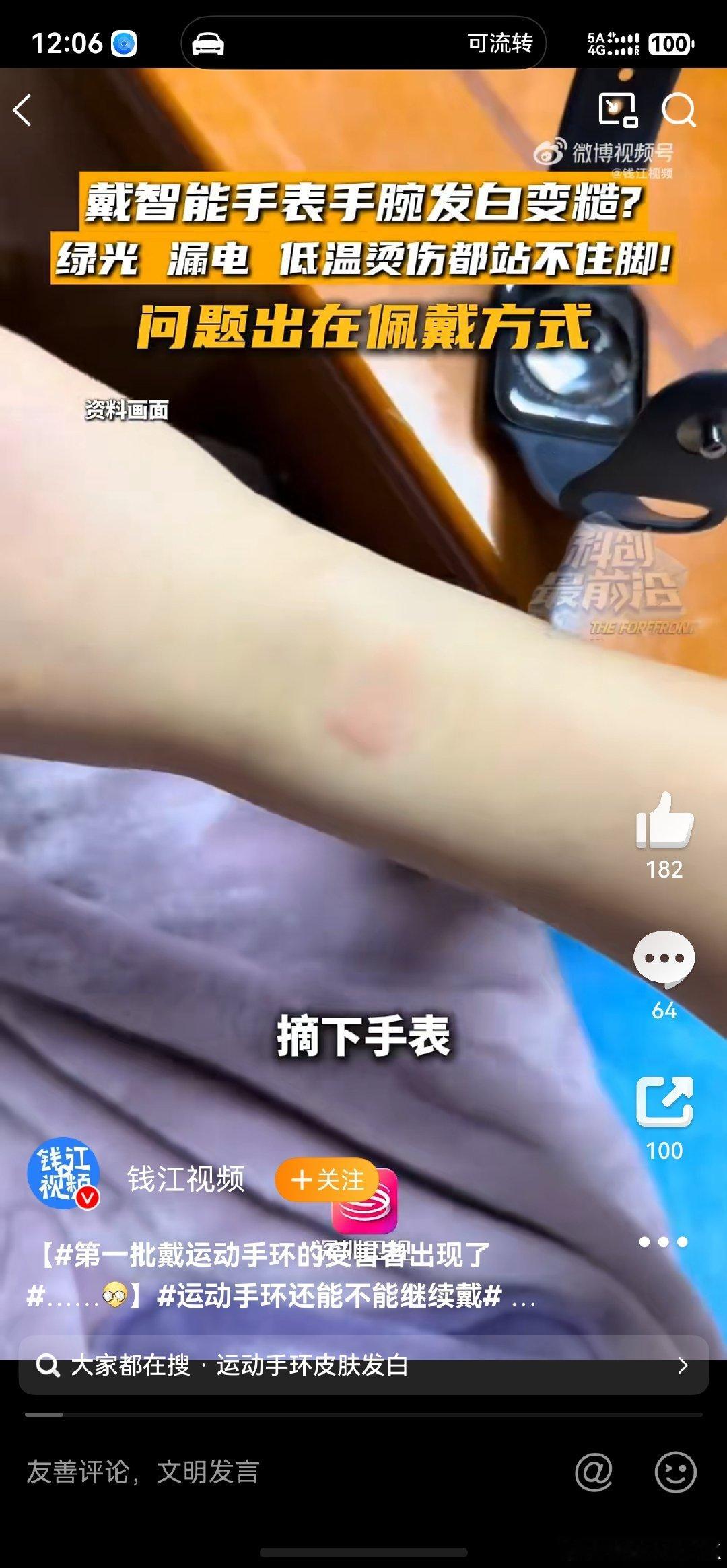 #第一批戴运动手环的受害者出现了#，很多人猜测手环绿光、漏电伤皮肤，但其实大多是闷汗、摩擦引发的接触性皮炎。 或者是对手表及表带材质过敏。
    所以大家放心戴吧，如果闷汗的话，把表节调宽一点，不要那么紧的贴着。[吃瓜] ​