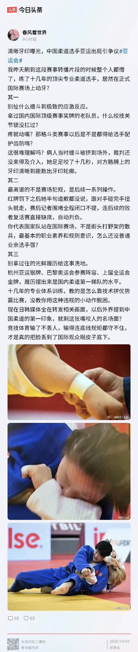 [允悲][允悲][允悲]
咬人还有理了吗？ ​