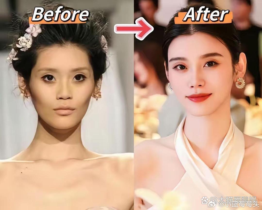不得不承认，有钱人的医美和普通人的医美，完全不在一个审美上。看看奚梦瑶，从前的脸颧骨支棱、眼窝深陷、下颌锋利，是时尚圈偏爱的“高级凶相”。如今全脸线条圆润，苹果肌饱满，太阳穴充盈，从凌厉超模直接切到温润“富贵花”。普通人做医美往往盯着某个局部的“缺陷”，追求标准化的精致五官；而高 ​