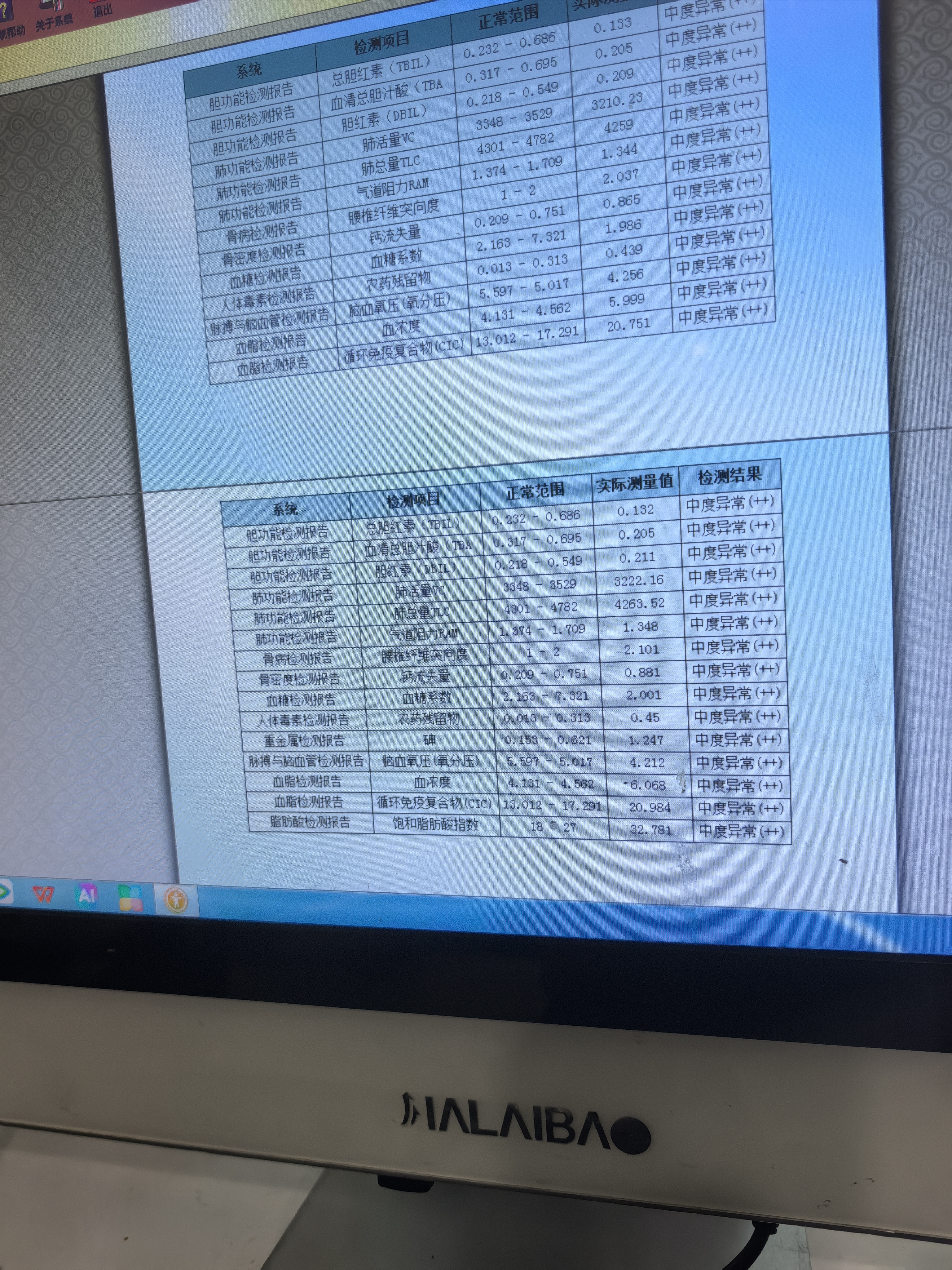 詹姆斯加盟76人能拿到总冠军吗能