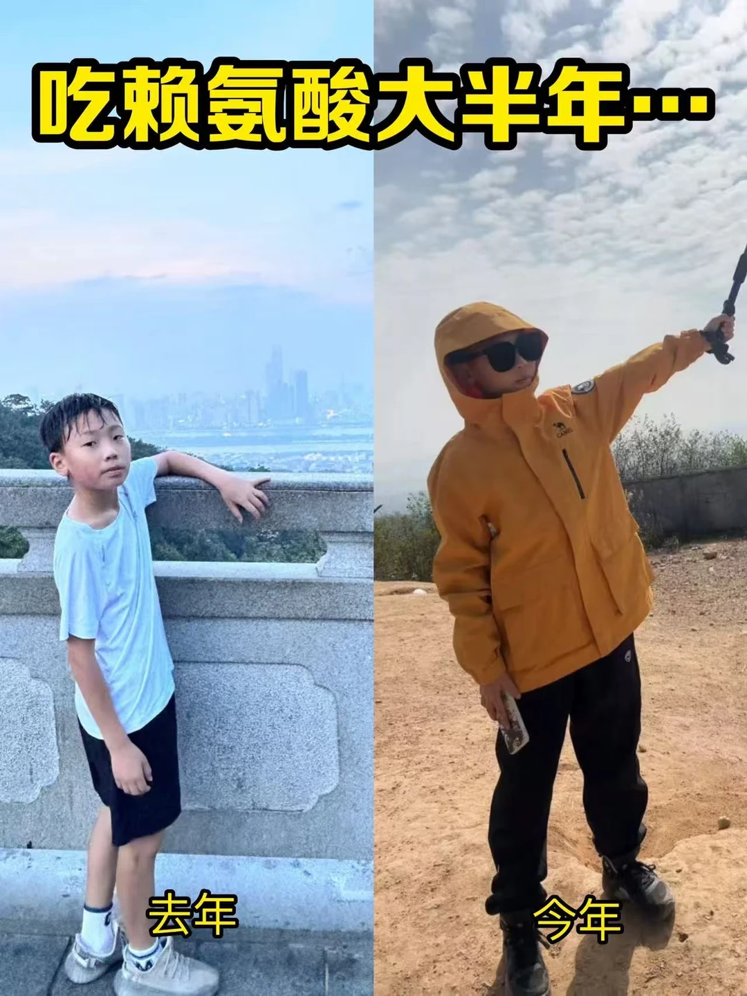 吃赖氨酸半年，娃的变化...