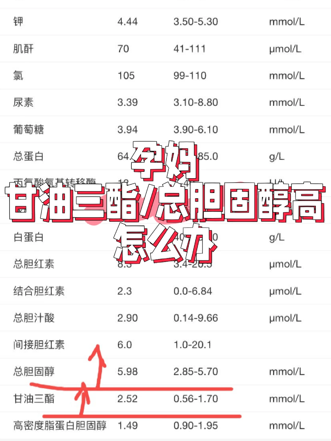 段涛医生说｜怀孕甘油三酯胆固醇升高怎么办
