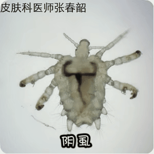 [哆啦A梦害怕]#医生在4岁宝宝睫毛上发现阴虱#

阴虱，是个体长为 0.8~1.2mm 的半透明寄生虫，主要靠吸食人血生存。

成虫如果不吸血，24小时内就会死亡；离开人体后，最多活 48 小时。

它们喜欢把卵产在阴毛、眉毛、睫毛、胸毛、腿毛等区域，叮咬你时，释放的唾液会让你奇痒无比！你可能还能看到毛发 ​