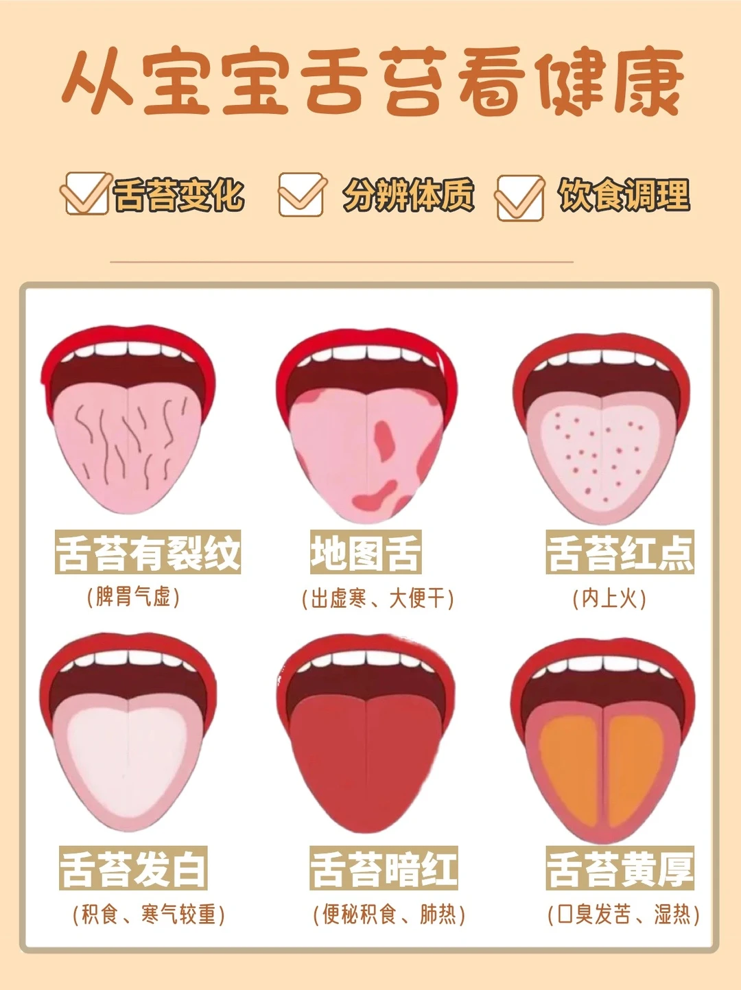 教你如何看懂舌苔小“学问”｜速速收藏