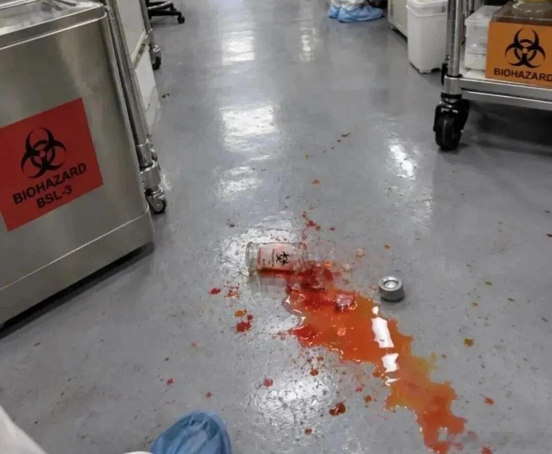 网传俄研究所人员死亡，很多人被鼠疫传闻搞得人心惶惶😮‍💨
其实不用过度恐慌，鼠疫从未彻底消失，但它是细菌性疾病，早期用抗生素治疗效果很好📌

现代城市完善环卫供水体系，切断老鼠跳蚤传播链，很难复刻中世纪黑死病大规模流行。
近年病例大多集中在卫生条件薄弱地区，我国也有零星个案，整 ​