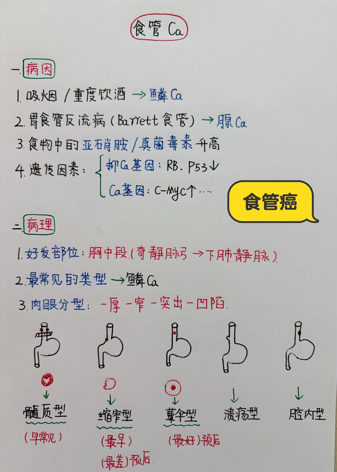 今日学习打卡——食管Ca