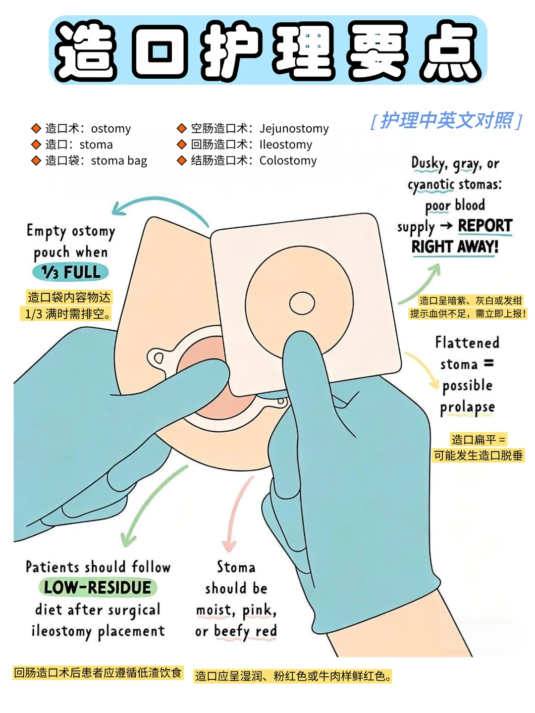 备考RN/造口护理要点！！学！！单词