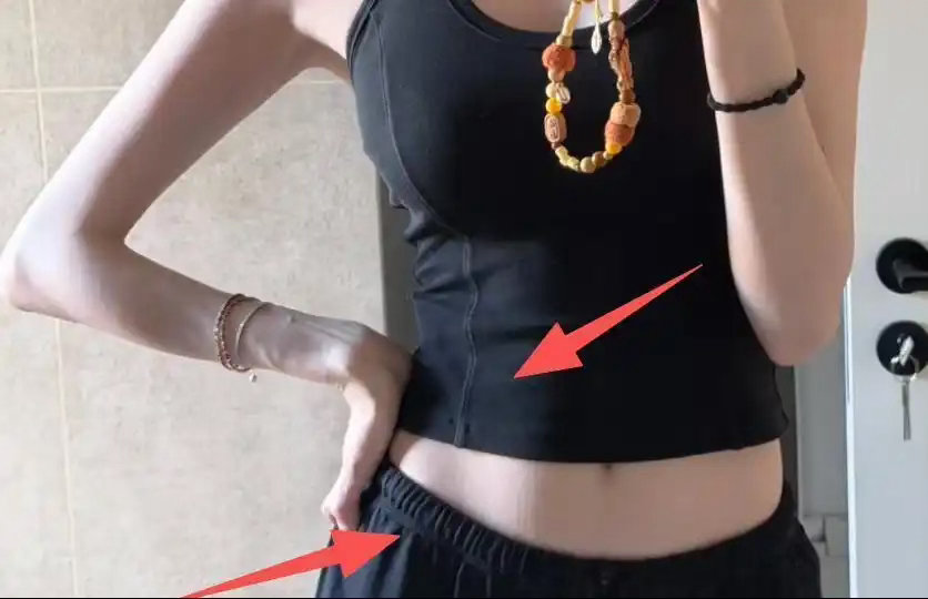 何穗产后清宫两次、妊娠纹爬满肚子，却拒绝P图：孩子来过的证据，凭什么要修掉？ ​