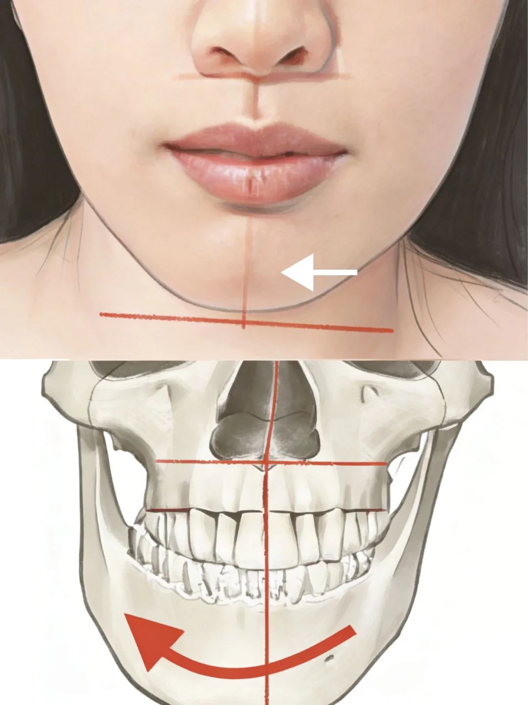 下巴歪了，光靠整牙能回来吗？base上海