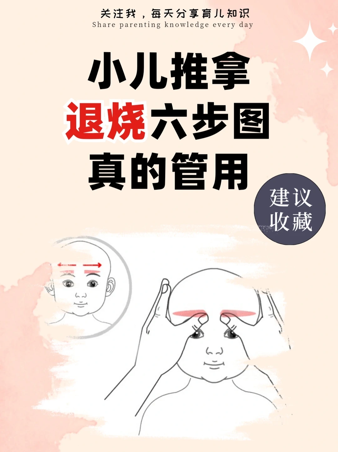 小月龄宝宝发烧，试试推拿！！！
