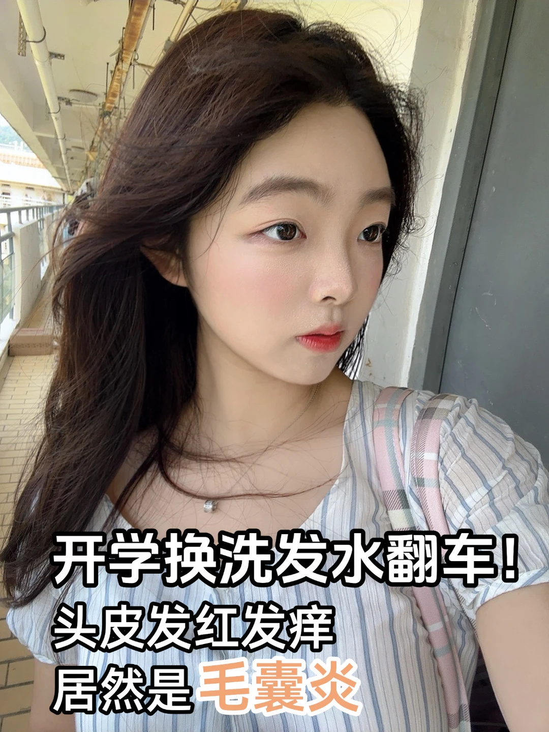头皮发红发痒！先别乱换洗发水