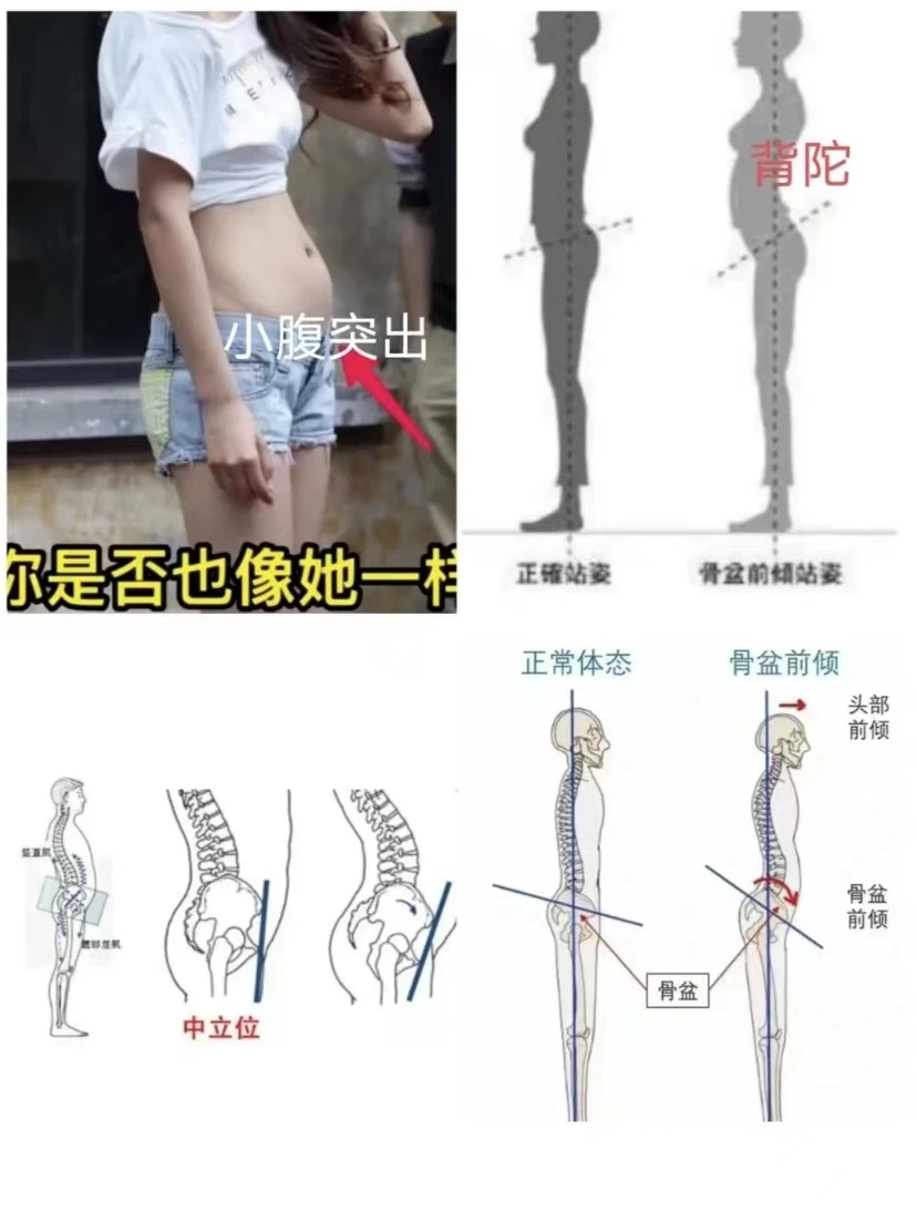 改善骨盆前倾问题(久坐上班简易版)