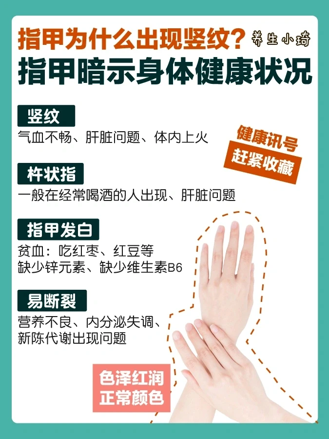指甲长竖纹｜指甲暗示着身体的健康状况