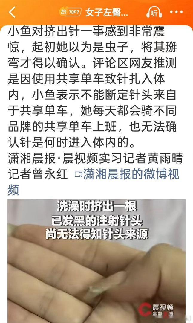 浙江女子洗澡时从左臀挤出一根4厘米长、已经生锈发黑的注射针头，这根在体内潜伏了一个月的“异物”，直到当事人减肥瘦下来才被身体感知到。

这起事件最让人后背发凉的，不是针头本身的锈蚀程度，而是它在人体内长期滞留的“无痛感”。医学上解释，臀部脂肪层痛觉神经分布极少，加上针头恰好避开了承 ​