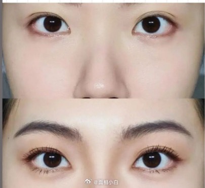 两个眼睛距离太近的人，内心细腻，遇事斤斤计较，比较贪吃喝玩乐。尤其是在感情路上偏执而自私，看不得对方有一点缺陷。 ​​​