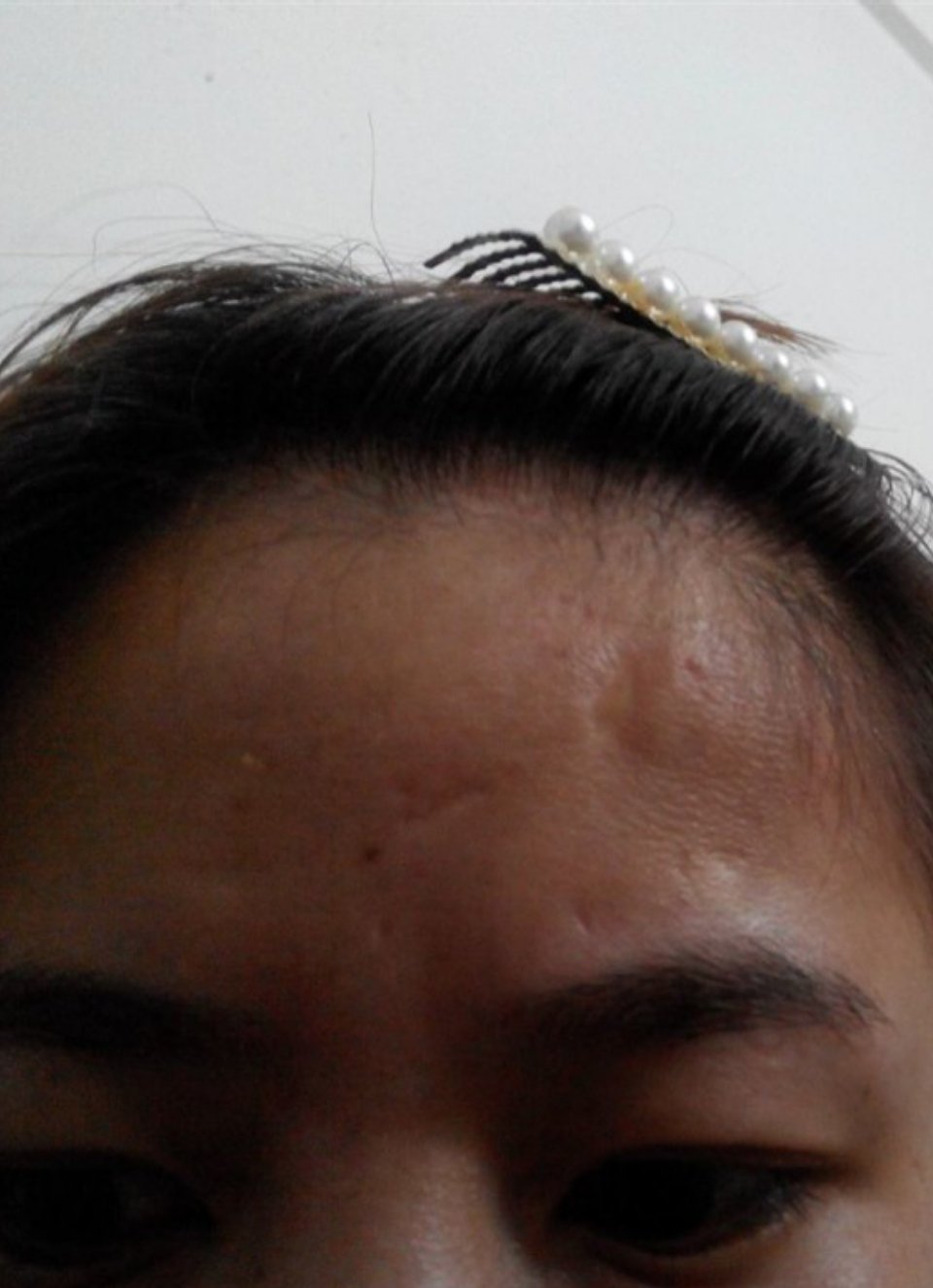 眉毛上去的叫福德宫，如果福德宫塌陷，此人会触犯法，福德宫有伤疤，有车祸之灾。 ​
