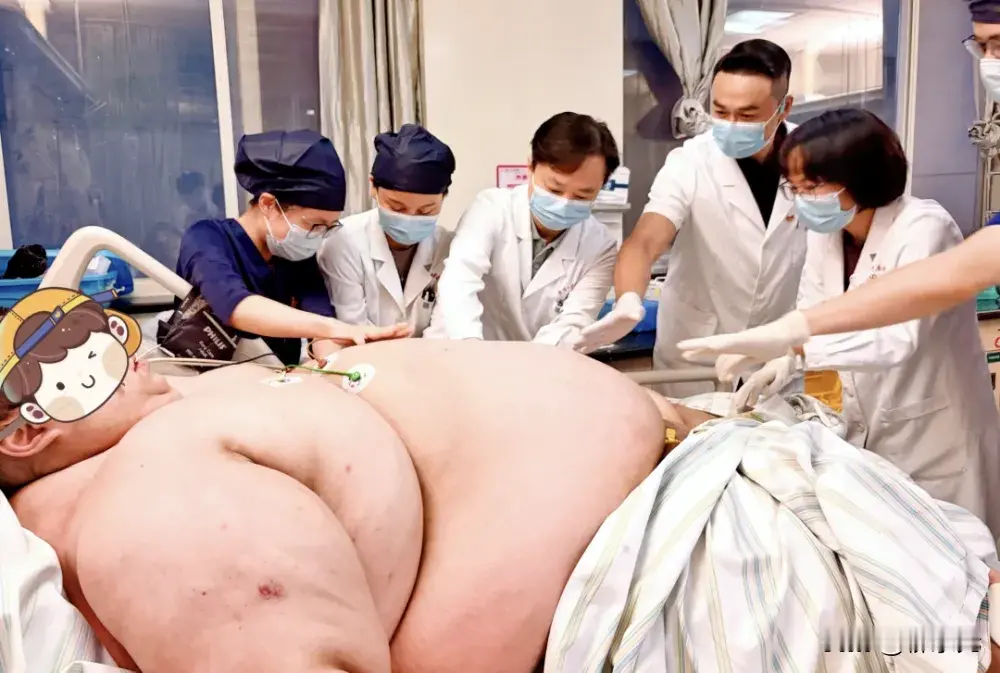全国第二重！635斤东北小伙包车赴武汉减重，在ICU闯过13天生死关