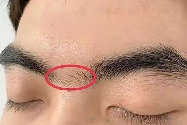 眉锁印堂，就是命宫的这个部位，如杂草丛生一般，就要把眉毛拔掉，命宫这个部位一定要光亮。1、命宫狭窄，心胸比较窄，爱钻牛角尖。2、命宫太宽，缺乏主见，容易相信别人，尤其是易被骗，少借钱出去。 ​​​