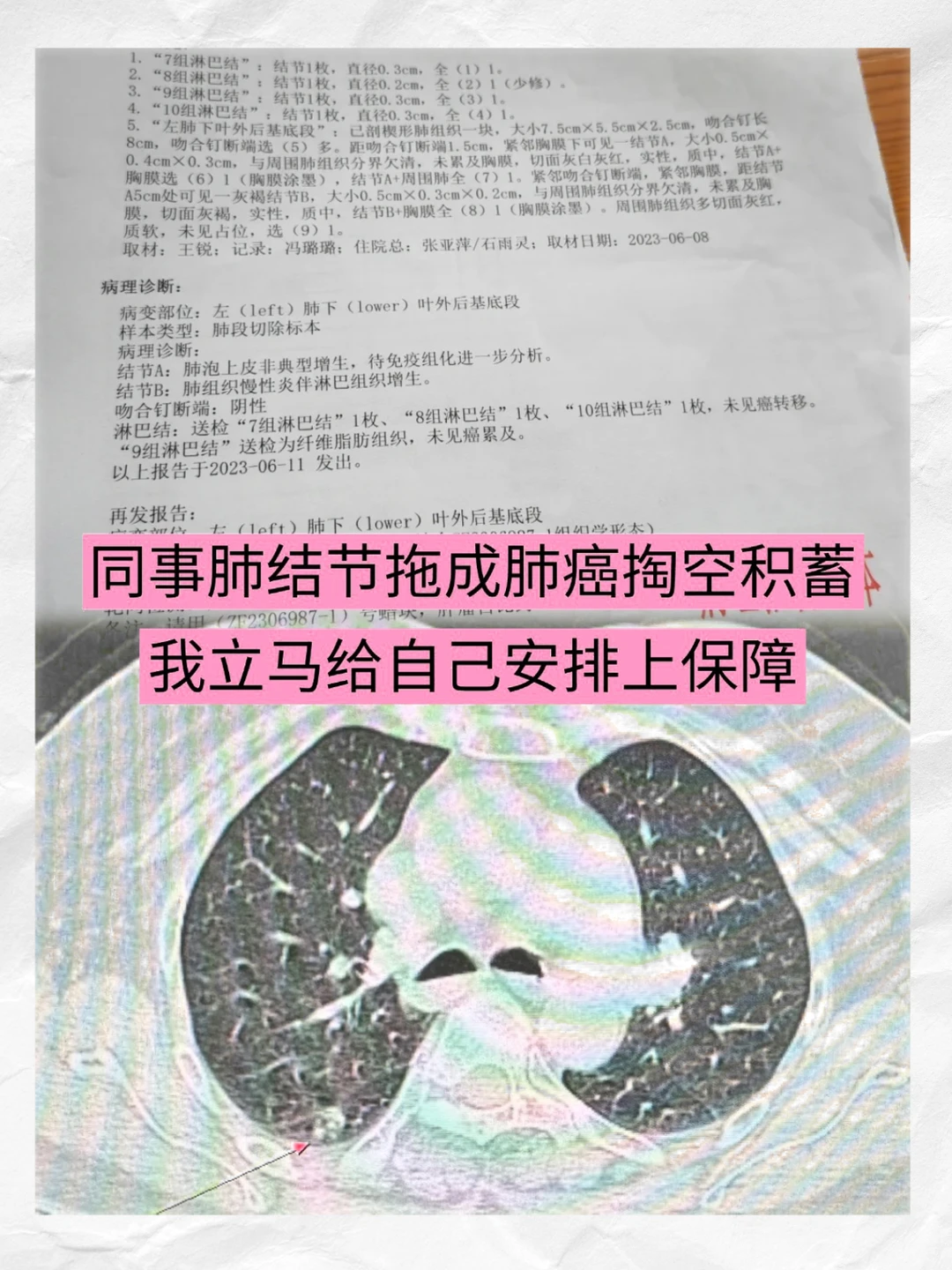 同事肺结节拖成肺癌，我才意识到保险重要性