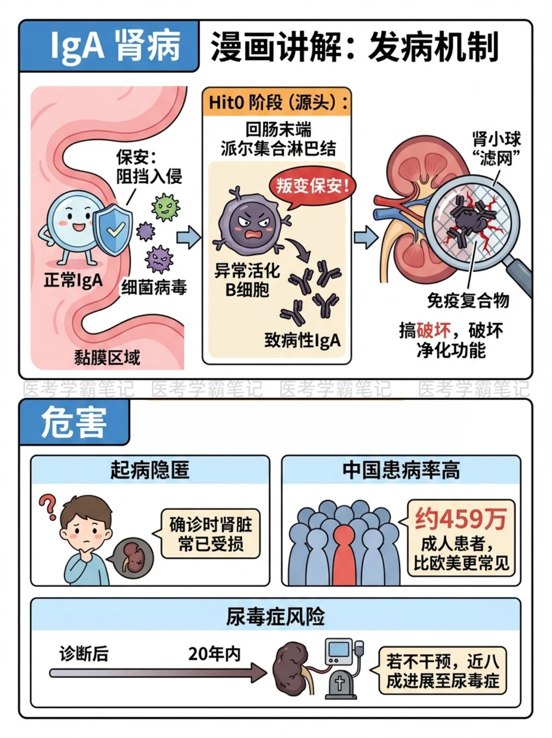 阿虎医考笔记：IgA肾病