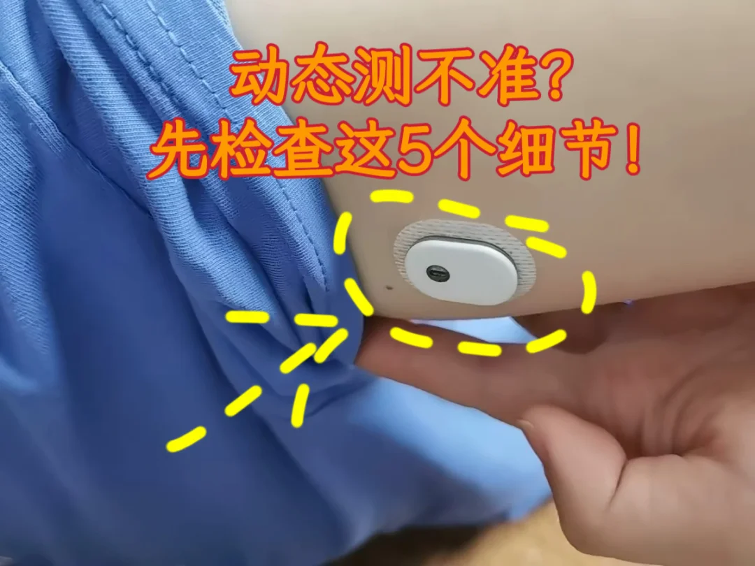 动态测不准？先检查这5个细节