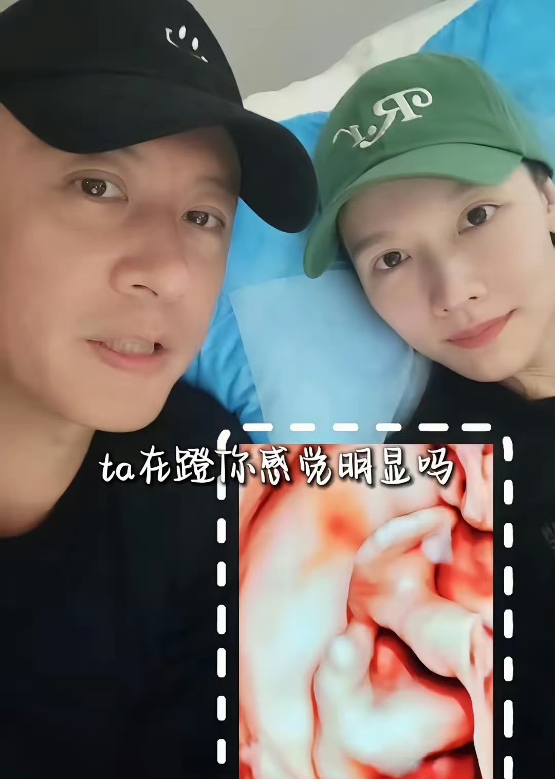 任重现在把所有工作都推了
专心在家陪着孙骁骁
是一点也不差钱，孙骁骁做四维去的是私立医院

任重都能和孙骁骁一起进B超室，看看孩子长得怎么样，孩子高鼻梁眼睛也不小。

2个人一直讨论二宝长得怎么样，孙骁骁怀孕变漂亮了，身材还是一如既往的好。

太羡慕他们的生活，一年不工作问你问题，大宝上学专车接送，