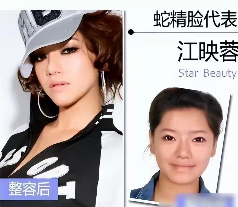 你骂得太狠了，江映蓉在台上直接哭崩。丁太升盯着她问，09年超女冠军，十一年了，怎么混得比曾轶可郁可唯还差。一句话把整容、过气、没作品全戳穿了。她捂着脸说讲话不敢，做动作也不敢，当年那个又唱又跳的冠军，现在站台上连手都不知道往哪放。这些年她脸换了又换，商演价跌了七成，综艺上一哭反倒上了热搜第一。观众不