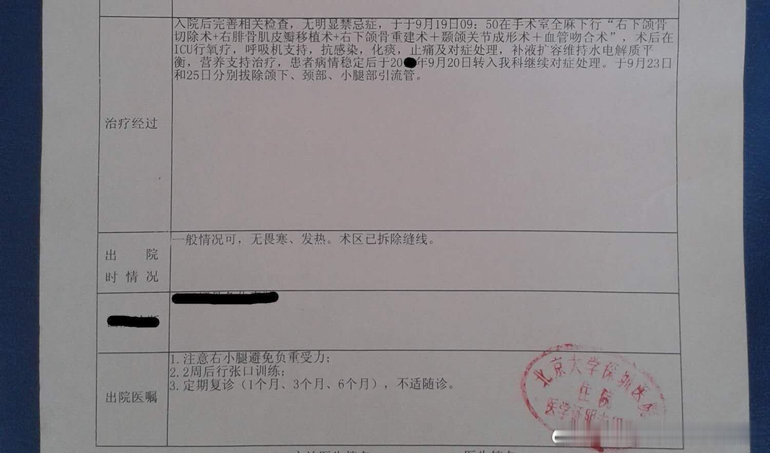#男子每天喝2000毫升水得结石了#广东省深圳市北京大学深圳医院做的5次手术，第1次至第3次手术做根管治疗和牙下面两个圆空洞位置已经康复没有圆空洞，第4次手术换的腓骨和加的长弯型的台板，过了一段时间第1次至第3次手术位置病情复发有了圆空洞至今未愈，请评论手术和台板固定位置! ​