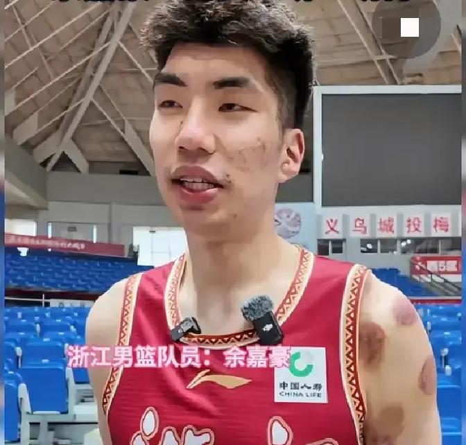 浙江
稠州男篮最近这几场打得，真是让人看得心里发毛。连
着赢了两场硬仗，看着好像又支棱起来了，但只要翻开数据细看，那股
子不对劲儿的味道，压根儿藏不住。
明明休赛期又是把余嘉豪给盼
回来了，又是重金招揽了孟子凯和扎加尔斯，这阵容摆在那儿，谁
不得多看一眼？可打到现在，开局先栽给广州，后面