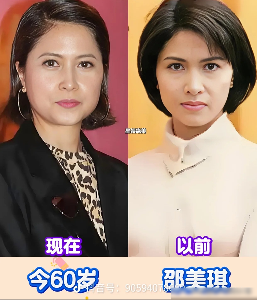 65岁惠英红，一年到头十个月泡在片场，腰疼、腿伤、鼻子断了全靠嘴喘气，就是不肯停。
刚拿下华表奖影后，转身又进组《数到三》，演一个死了孩子的舞蹈老师。首映礼上，没人看出她心脏里还放过支架。
当年25岁，她正当红，豪门追上门，她扭头回邵氏拍打戏养家。38岁没戏拍，抑郁到想死，硬是自己爬回来。
别