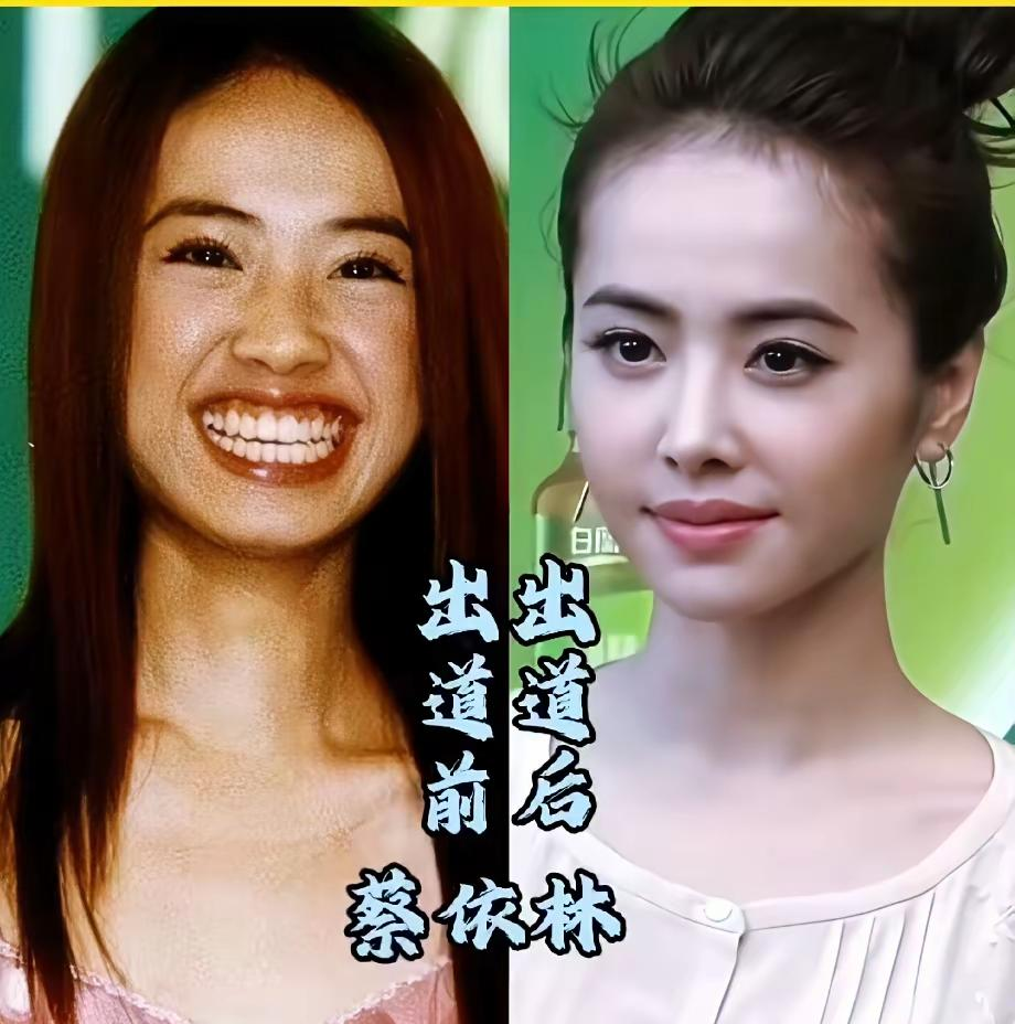 蔡依林的变化根本不是整容疑云能解释的，这是娱乐圈最狠的“红气养人”活体教科书！
台湾医美医师林建宏对比蔡依林二十多年前的出道照后直接点名：鼻子可能动过，牙齿肯定矫正了。早期的她圆脸、厚唇、鼻翼宽大，上排牙明显外突，嘴唇常常没办法自然闭合，站在王菲和陈慧琳旁边被网友调侃像凤姐。但说实话，这些分析只对了