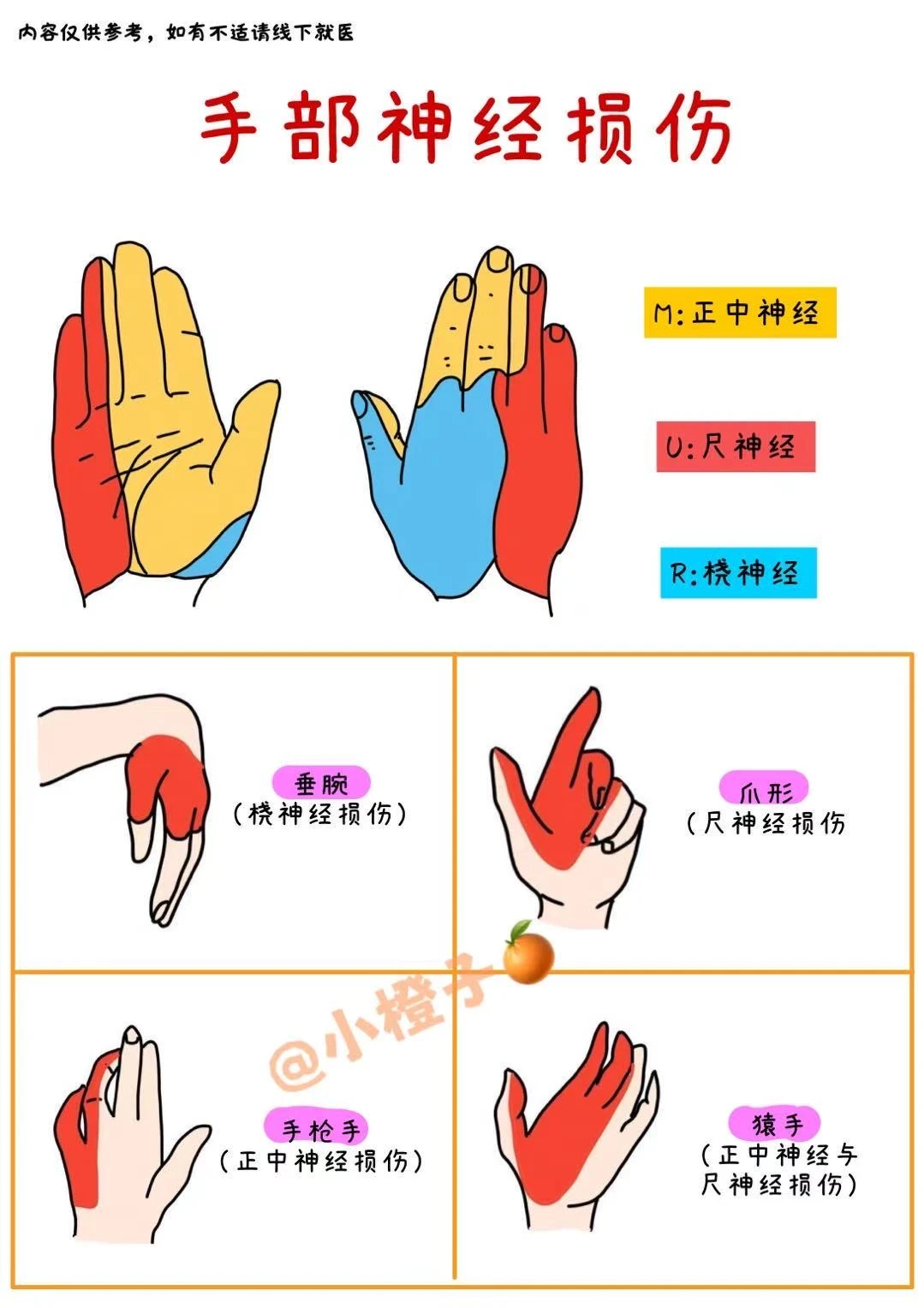 📖手部神经损伤✅一篇讲清楚‼️