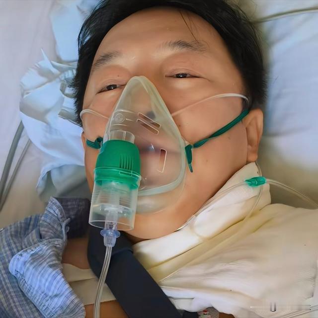 太可怕了！52岁黄渤在家门口突发意外被紧急送往医院。
9月3日，黄渤在自家门口骑车不幸摔倒，经检查发现锁骨骨折。后黄渤在医院的影像资料流出，左肩缠满绷带，仅右手可以活动，看上去非常严重。
有网友评论：骑自行车撞成锁骨骨折完全就是“疯狂赛车”
黄渤也发文告诫大家：“骑车千万不能一心二用，三心二意，要一