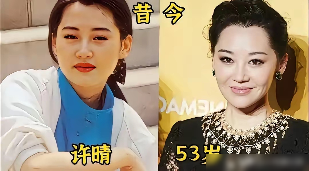 50岁女星连双下巴都不藏了，普通女人还在为两条法令纹砸钱焦虑。
9月8日，林心如素颜逛景区被偶遇。没戴大墨镜，没穿紧身裙，一身黑色户外服配灰裤子，活脱脱一个普通游客。
路人偷拍的生图里，双下巴一览无余。换作别人早让团队全网删图了，她却大方跑去自嘲。54岁的宁静也一样，被人指点穿搭，干脆直接拿自己