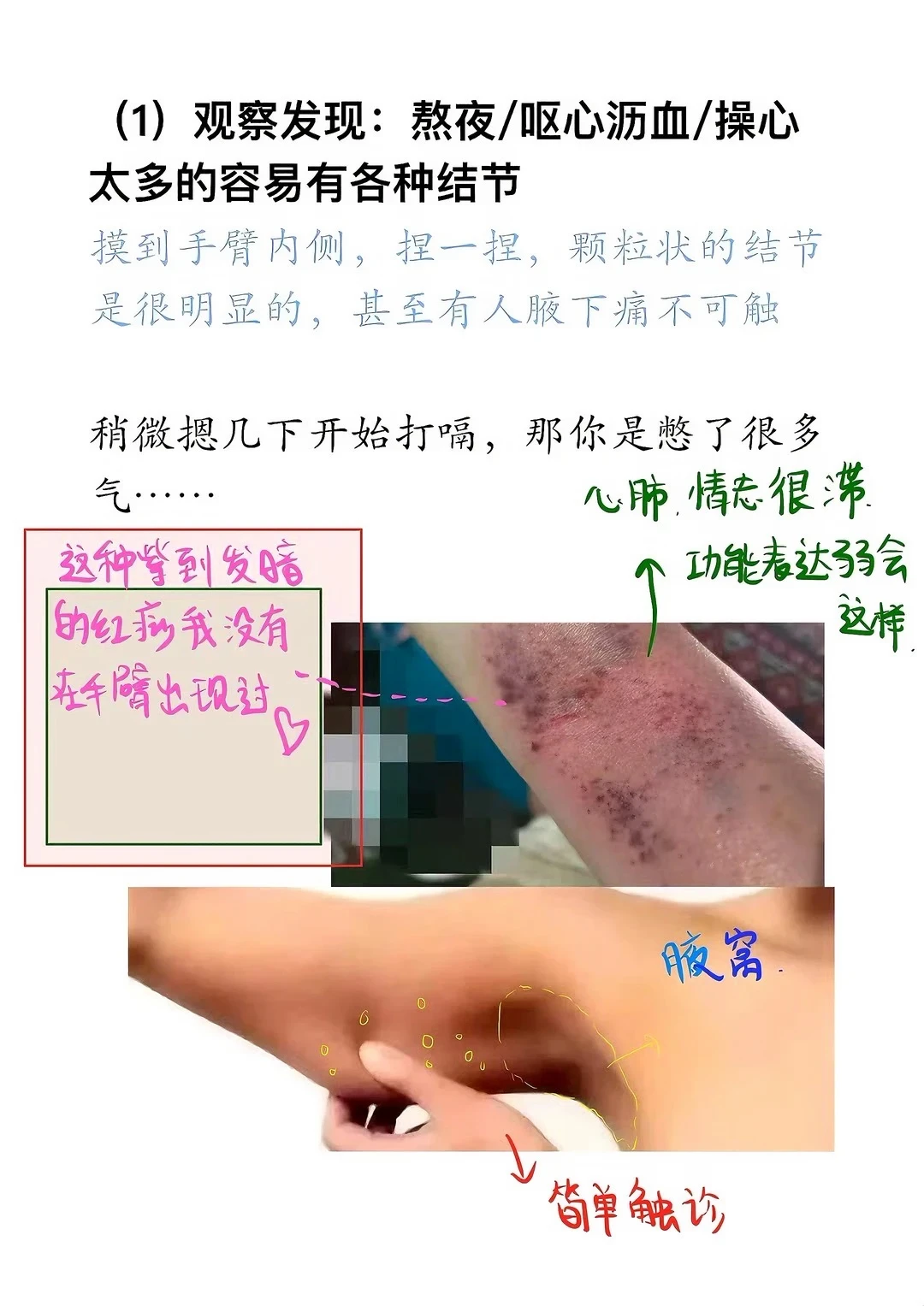 手臂内侧一旦疏通，缓解🐻结节是很快的！