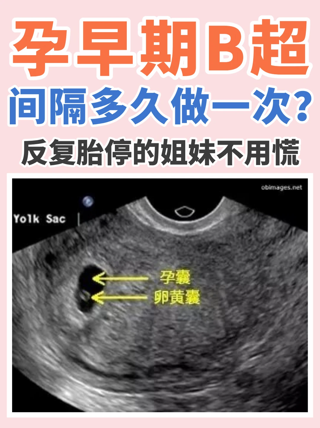 孕早期B超要查多少次？隔多久查一次B超？