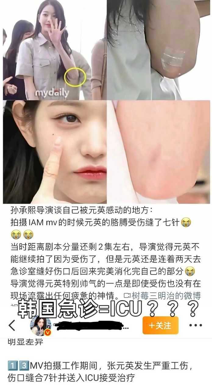 看来大粉很想让张元英进icu呢[泪奔] ​
