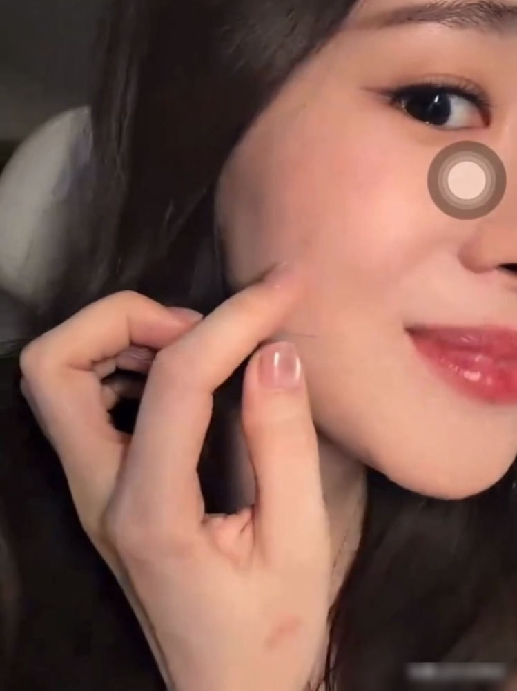 张碧晨脸上突然多俩坑，自己都懵了。
她直播说，录《天赐的声音》那天化妆，右脸莫名其妙凹进去一个酒窝。一个多月后，左边也长出来了，硬是凑成一对。网友翻旧照，以前脸上真没有。
医生讲了，酒窝就是肌肉跟皮粘一块儿了。年纪上来，脸上脂肪薄了，原本藏着的粘连点就露出来。说白了，瘦了，或者老了。
不用动刀
