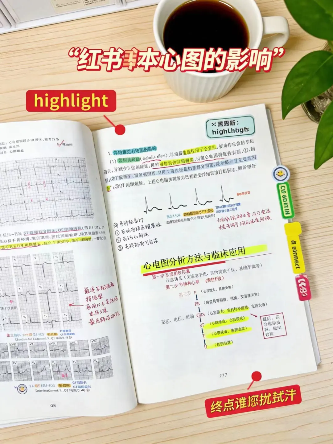 打工人，学生党实战心电图高效