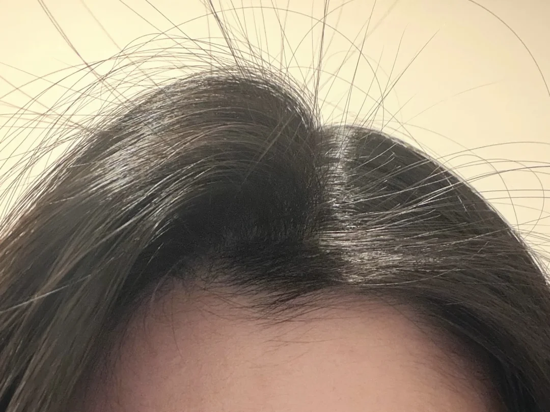 头油容易贴头皮的都去试试这个！！！！！！！！