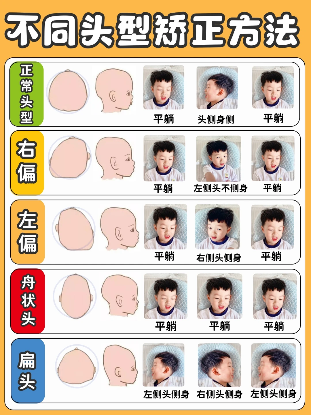宝妈必看：偏头/扁头/舟状头如何逆风翻盘！