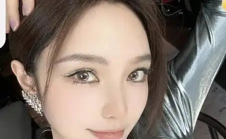 周扬青自曝脸馒化 医美填充乱象该降温了 ​