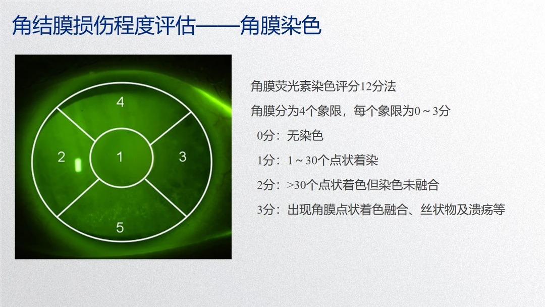 为什么医生给你角膜染色？