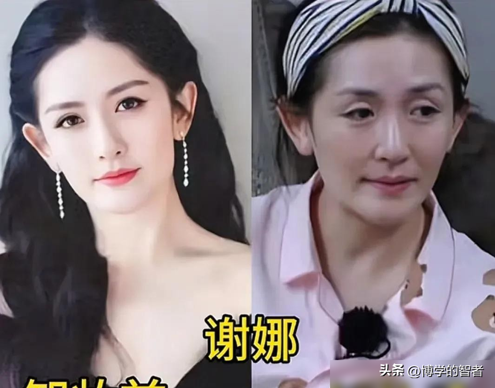 戚薇被逼问整容，直接甩一句：做过双眼皮手术算吗？空气突然安静。
刘涛更狠。她把自己健身后流汗、黑眼圈、额头爆痘的生图直接发出来。配文：这才是真实的我，接受不完美才是真正的自由。
评论区炸了。有人说她老了，有人说她状态差。刘涛没删，没解释，只补了一句，皱纹是时光的赠礼，强行抹平反而失去生命力。