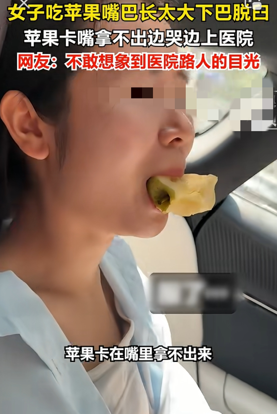 哭笑不得。2026年10月14日，浙江一名女子吃苹果，吃到最后一口时，刚一口咬下去，突然感觉嘴合不上了，苹果还卡在嘴里。女子在家尝试半天都取不出来，没办法，只好咬着苹果赶往医院求助。最后在医生的帮助下，才把嘴里的苹果取了出来。后来她才明白，原来是咬苹果时嘴巴张得太大，下巴突然脱臼，嘴巴就动弹不了。