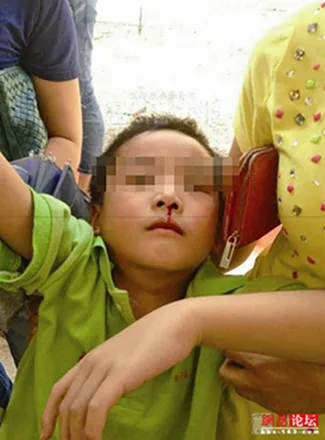 新校区开学就出事！多名孩子头晕流鼻血，校园安全容不得半点侥幸
近日，山东菏泽巨野县南关小学的家长们陷入焦虑。部分六年级学生新学期被安排转入麟州中学新校区上课，可开学没几天，不少孩子陆续出现头晕、流鼻血、咳嗽发烧等不适，有孩子就医后被诊断为刺激性气体中毒，家长纷纷质疑校区装修污染物超标，当地教体局已经